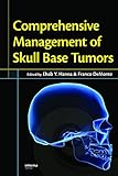 Comprehensive management of skull base tumors