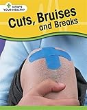 Cuts, bruises and breaks