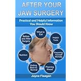after your jaw surgery practical and helpful information you should know