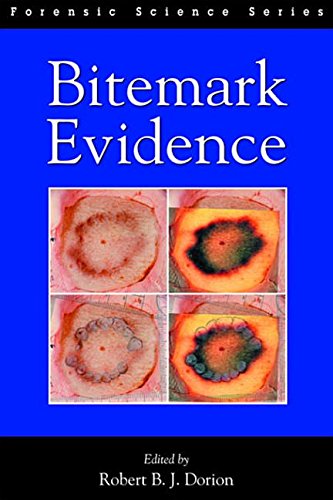 Bitemark Evidence (International Forensic Science and Investigation Series)