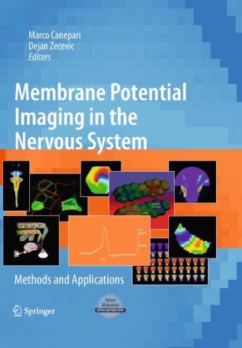 Membrane Potential Imaging in the Nervous System: Methods and Applications