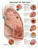 Diseases of the Lung Anatomical Chart Paper Unmounted