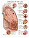Diseases of the Lung Anatomical Chart Paper Unmounted