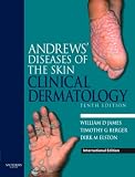 Andrews' Diseases of the Skin: Clinical Dermatology