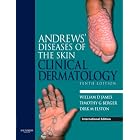 Andrews' Diseases of the Skin: Clinical Dermatology by  William D. James, Timothy Berger, and Dirk M. Elston
