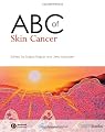 ABC of Skin Cancer (ABC Series)