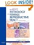 Robboy's Pathology of the Female Reproductive Tract: Expert Consult: Online and Print, 2e (Expert Consult Title: Online + Print)