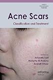 Acne scars : classification and treatment