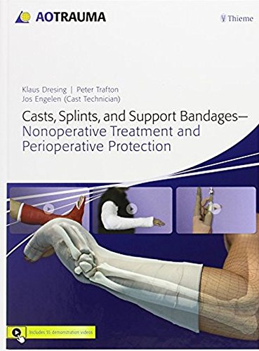 casts splints and support bandages nonoperative treatment and perioperative protection