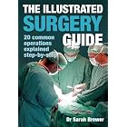 Click here to buy The Illustrated Surgery Guide: A Step-by-step Guide to 20 Common Operations by Dr. Sarah Brewer.