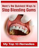 Here's the Quickest Ways to Stop Bleeding Gums - My Top 10 Remedies