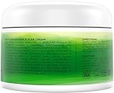 InstaNatural Stretch Mark & Scar Cream - Best Formula for Scar Removal & Prevention for Men & Women - Natural & Organic Moisturising Body Cream Treatment - Great for Before & After Pregnancy - 4 OZ