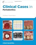 Clinical Cases in Periodontics