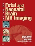 Atlas of Fetal and Postnatal Brain MR