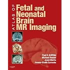 Click here to buy Atlas of Fetal and Postnatal Brain MR by Paul D. Griffiths FRCR PhD, Janet Morris MSc, Jeanne-Claudie Larroche MD, and Michael Reeves FRCR.