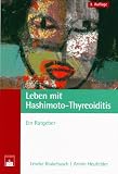 Leben mit Hashimoto-Thyreoiditis: Ein Ratgeber