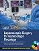 Search : Laparoscopic Surgery for Gynecologic Oncology