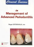 Clinical Success in Management of Advanced Periodontitis