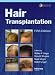Hair Transplantation (with Procedural DVD), Fifth Edition