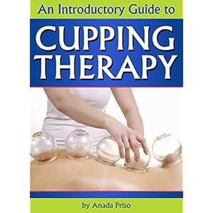 Cupping Therapy: An Essential Guide to Cupping Therapy, How it Works, and Its Benefits ( Suction Cup Therapy | Chinese Cupping | Bekam | Hijama | Vent
