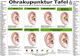 Ohrakupunktur Tafel - Indikation: Hauterkrankungen & Allergische Erkrankungen