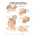 Whiplash Injuries of the Head and Neck