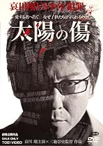 太陽の傷 [DVD]