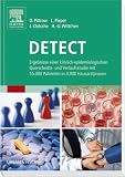 DETECT
