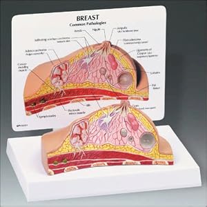Breast Cross Section Model by Anatomical Chart Company