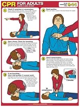 CPR for Adults 18" X 24" Laminated Poster