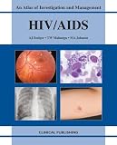 HIV/AIDS: An Atlas of Investigation and Management
