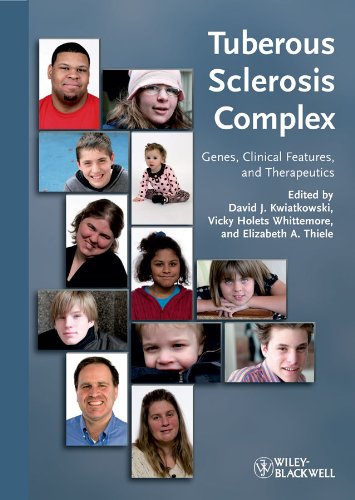 Tuberous Sclerosis Complex: Genes, Clinical Features and Therapeutics