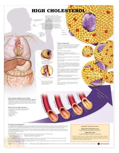 high cholesterol
