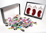Photo Jigsaw Puzzle of Spare kidneys from Science Photo Library