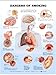 Dangers of Smoking Anatomical Chart