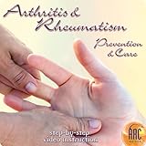 Arthritis 