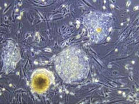 Stem Cells