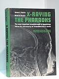 X-raying the pharaohs