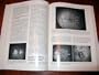 Essentials of Ophthalmology