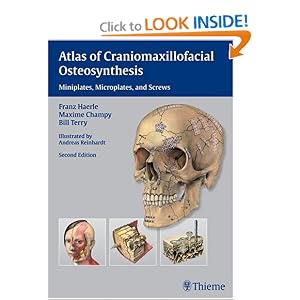 Click here to buy Atlas of Craniomaxillofacial Osteosynthesis: Microplates, Miniplates, and Screws by Franz Haerle, Maxime Champy, and Bill Terry.