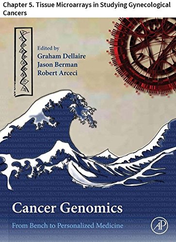 Cancer Genomics: Chapter 5. Tissue Microarrays in Studying Gynecological Cancers