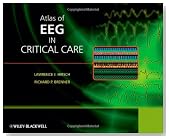 Atlas of EEG in Critical Care