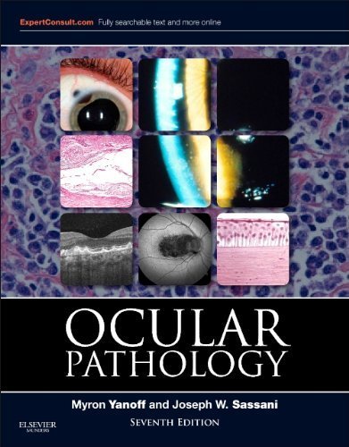 Ocular Pathology, 7e (Expert Consult Title: Online + Print) by Myron Yanoff MD (2014-06-10)