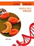 Sickle Cell Disease (Genes & Disease)