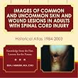 Images of Common and Uncommon Skin and Wound Lesions in Adults with Spinal Cord Injury: Historical Atlas: 1984 - 2003