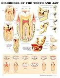 Disorders of the Teeth and Jaw Anatomical Chart