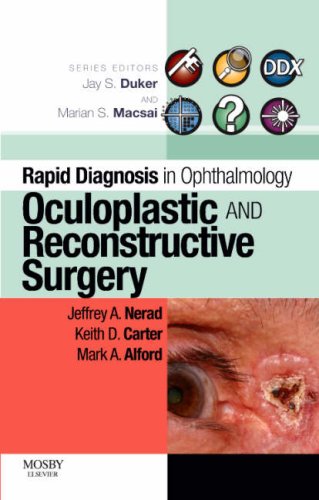 City Travel Guides Discounted  Books : Rapid Diagnosis in Ophthalmology Series: Oculoplastic and Reconstructive Surgery