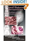 Crystal-Induced Arthropathies: Gout, Pseudogout and Apatite-Associated Syndromes