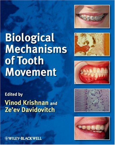 Biological Mechanisms of Tooth Movement