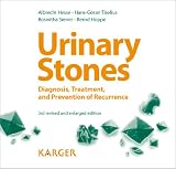 Urinary Stones: Diagnosis, Treatment, and Prevention of Recurrence